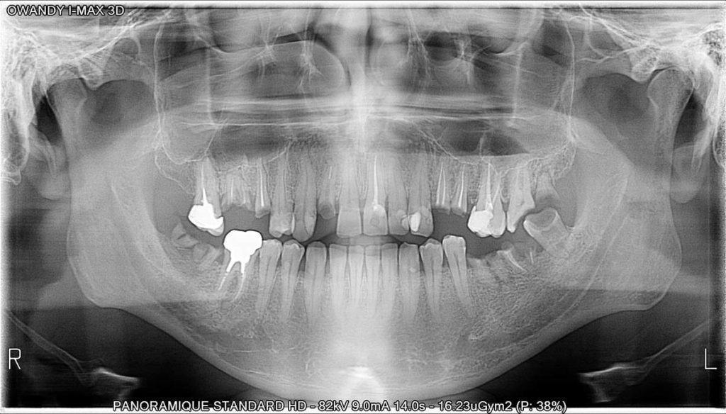 Panoramica dentale I-Max - Owandy Radiology Italia