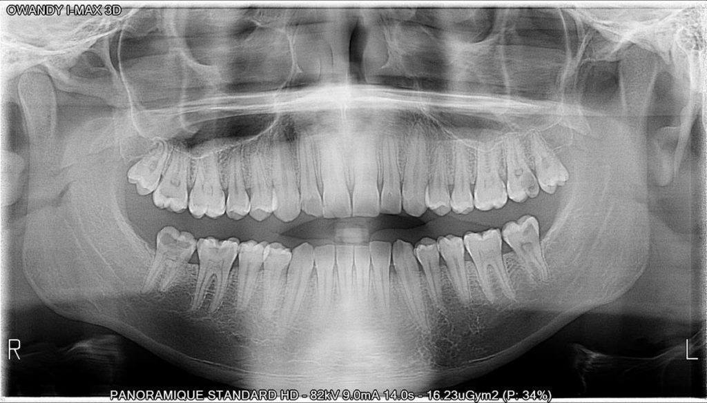 Panoramica dentale I-Max - Owandy Radiology Italia